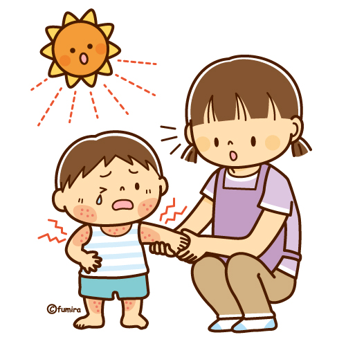 紫外線アレルギーで湿疹が出た子どもとママのイラスト（ソフト）